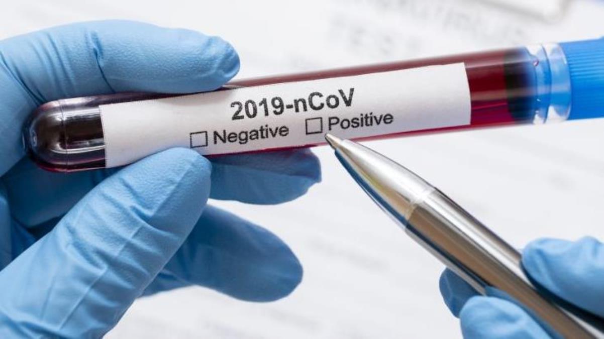 Kovid-19 salgını küresel acil durum olmaktan çıktı