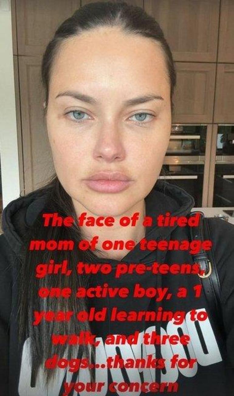 Adriana Lima'dan estetik iddialarına yanıt: Yorgun bir annenin yüzü!