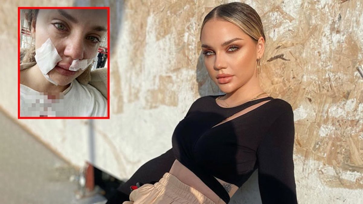 Sosyal medya fenomeni Cansu Yeğin, köpeğinin saldırısına uğradı