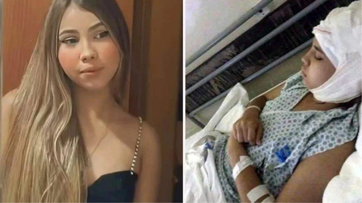 Karting yarışında aracın motoruna saçını kaptıran genç kızın kafa derisi koptu