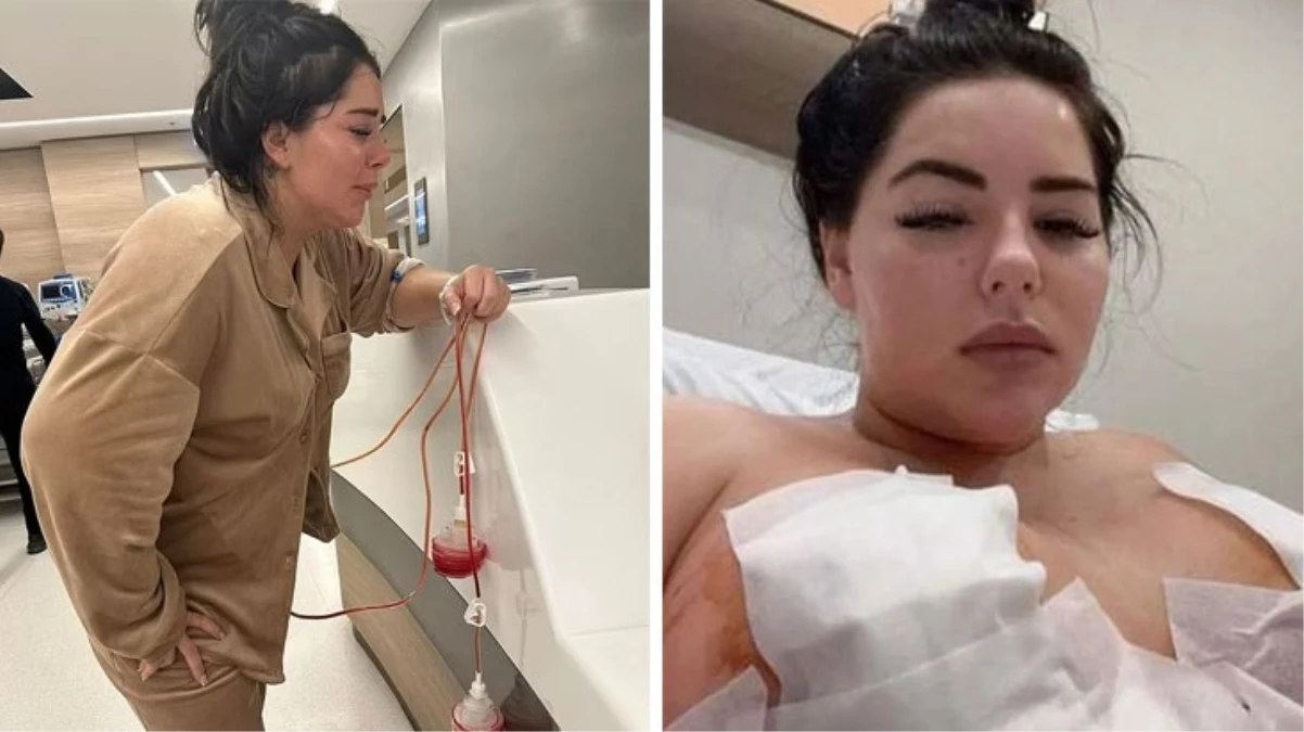 Meme dikleştirme operasyonu geçiren İngiliz model Chloe Rose’un göğüs uçları çürüdü