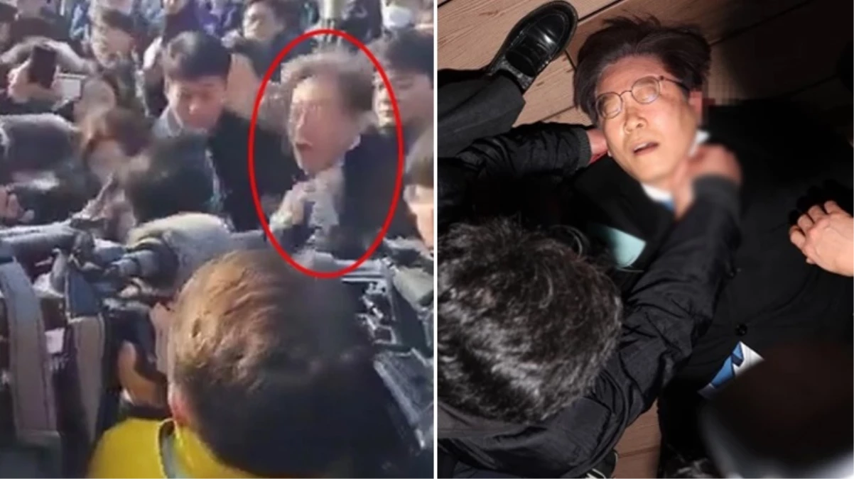 Güney Kore’de ana muhalefet lideri Lee Jae-myung bıçaklı saldırıya uğradı