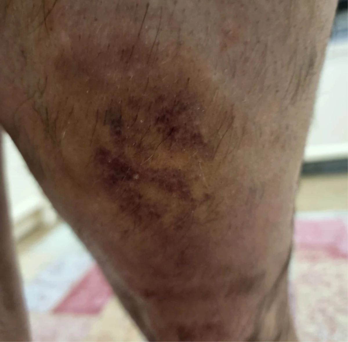 Öğrenci, öğretmeni tarafından sopayla dövüldü