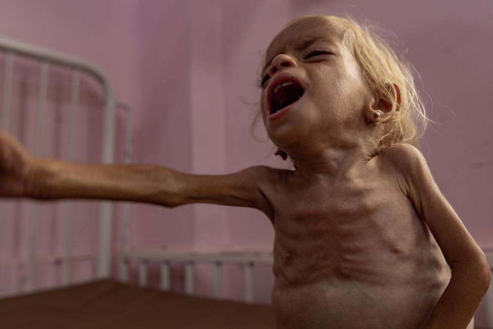 Gazze’de 3 Filistinli daha açlık nedeniyle hayatını kaybetti