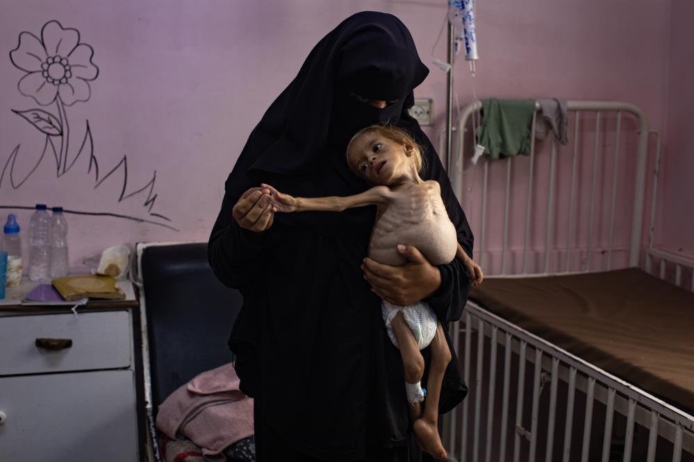 Gazze’de son 24 saatte 2’si çocuk 4 sivil açlıktan öldü